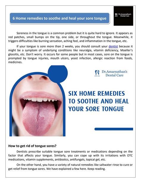 6 Home Remedies to soothe and heal your sore tongue by Dr. Suresh - Issuu