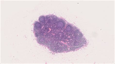 Lymph Node – Normal Histology – NUS Pathweb :: NUS Pathweb