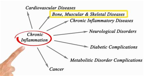 Is Inflammation Behind Your Bone Loss? - Nurtured Bones