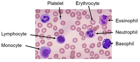 The Truth That Stares Us in The Face in Our Blood Panels – Lyme Disease ...