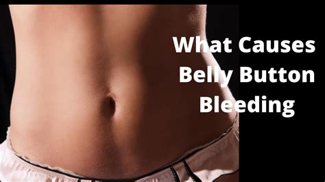 What Causes Belly Button Bleeding - YouTube