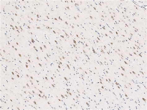 Anti-Calbindin Antibody, Rabbit PAb, 102051-T40 | Sino Biological