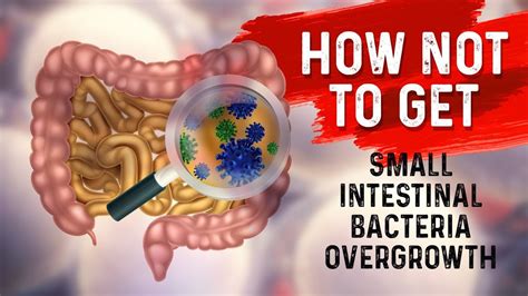 Bacterial overgrowth in stomach - tikloao