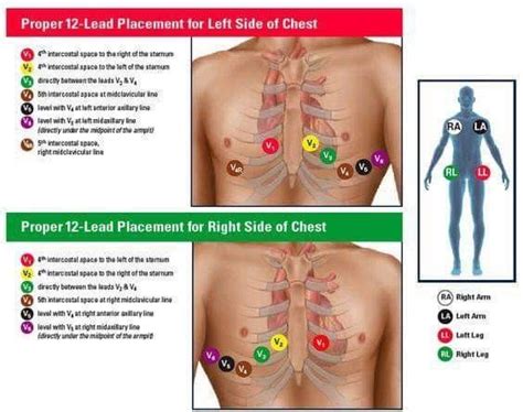 Top 10 ekg placement ideas and inspiration