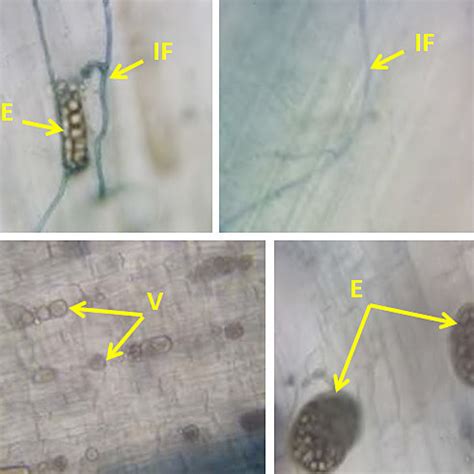 Microscopic observation of some of arbuscular mycorrhizae structures in ...