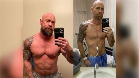 San Francisco nurse Mike Shultz shares shocking before-and-after photos of COVID-19 battle ...