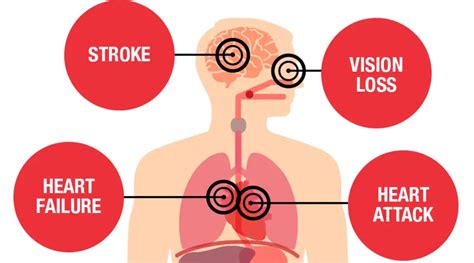 35 Surprising Facts About High Blood Pressure You Need to Know ...