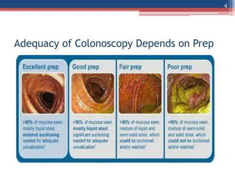 Colonoscopy Preparation