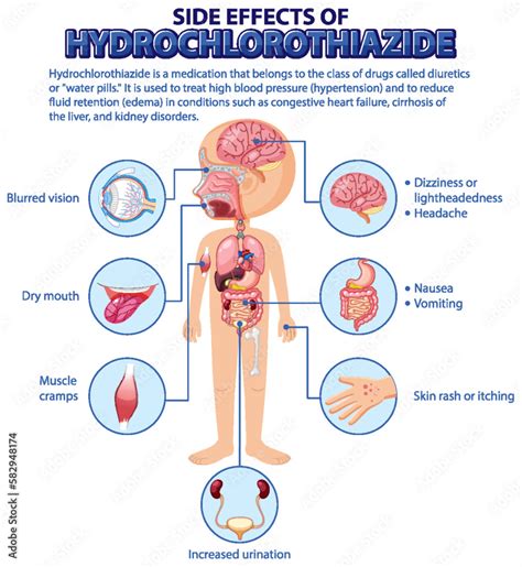 Human anatomy diagram cartoon style of hydrochlorothiazide side effects ...