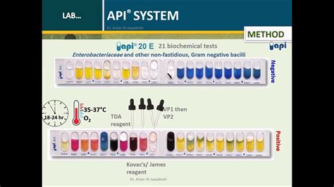 API System for Diagnostic Microbiology: An Overview - YouTube