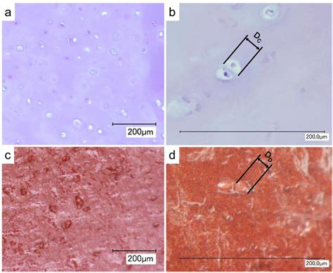 Microscopy images of HE stained sections of human costal cartilage (a,... | Download Scientific ...