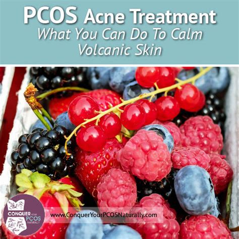 PCOS Acne Treatment | Conquer Your PCOS Naturally