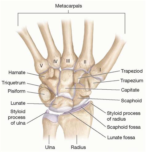 Management of Wrist Fractures | Plastic Surgery Key