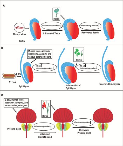 2 Pictorial representation of (A) orchitis: orchitis is the ...