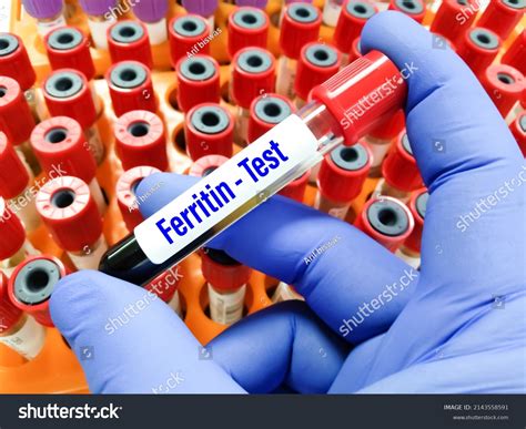 Blood Sample Tube Ferritin Level Test Stock Photo 2143558591 | Shutterstock