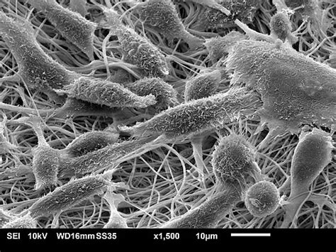 Fibroblasts - Histology, Wound Healing, and Macrophages/Myofibroblasts