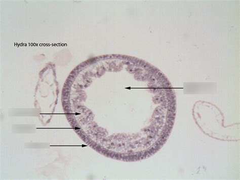 BIO 121 Lab 6 Hydra Diagram | Quizlet