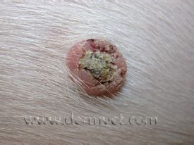 Papilloma, Viral in Lacey, WA | Dermatology Clinic for Animals