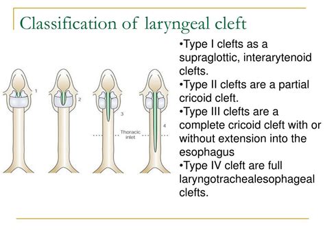 PPT - Congenital Anomalies of Larynx PowerPoint Presentation, free download - ID:5353904