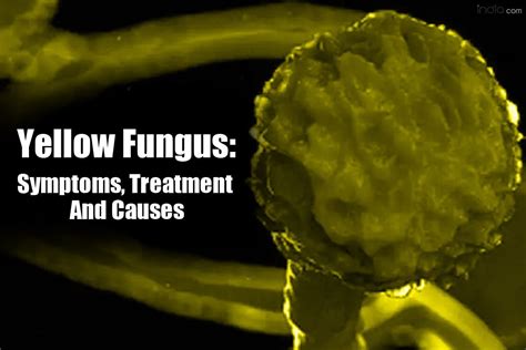 Symptoms, Prevention And Causes of Yellow Fungus, Black Fungus And ...