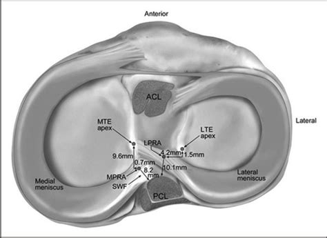 —anatomy of posterior roots. Mte: medial tibial eminence; lte: lateral... | Download Scientific ...