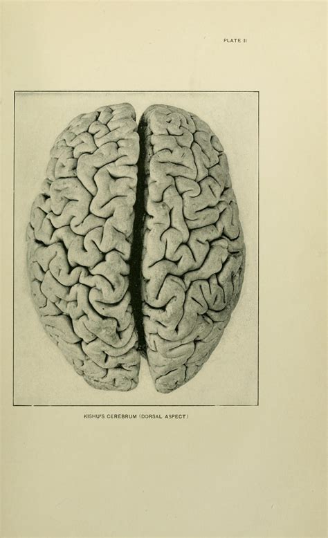 Dolphin Brain Anatomy | PeepsBurgh.Com