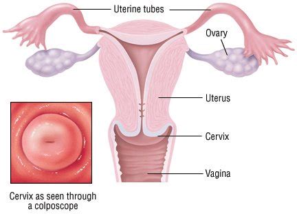 Cervical Polyps Guide: Causes, Symptoms and Treatment Options