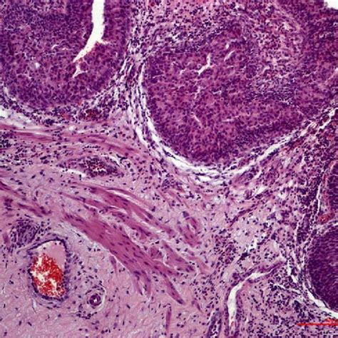 Full article: Antigenic Profile of Muscularis Mucosae and Muscularis ...