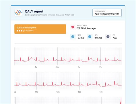 What Junctional Rhythm Looks Like on Your Watch ECG | Qaly