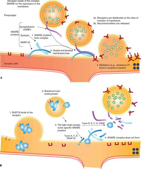 Botulinum Toxin in Movement Disorders | Neupsy Key