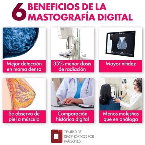 Mastografía digital | Realizarte una mastografía anual es importante para la detección temprana ...