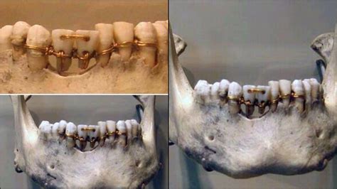 Incredible dental work found on a 4,000-year-old mummy of Ancient Egypt | The African History