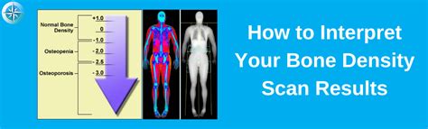 How to Interpret Your Bone Density Scan Results - True North Wellness