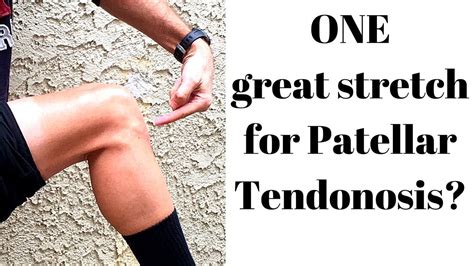 Exercises To Fix Knee Tendinitis Patellar Tendonitis Knee Tendonitis | The Best Porn Website