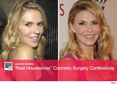 Brandi Glanville Reveals Shocking Cosmetic Surgery Procedure | toofab.com