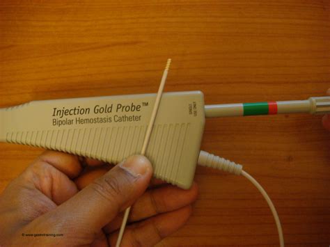 Gastroenterology Education and CPD for trainees and specialists » Use of Gold probe