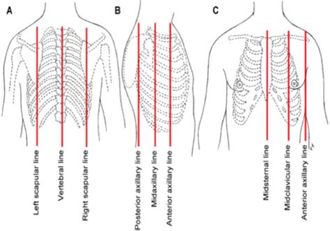 Midscapular Line