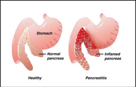 Pancreatitis in Dogs | Healthy Paws