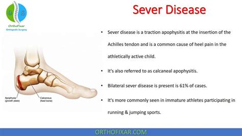 Calcaneal Apophysitis