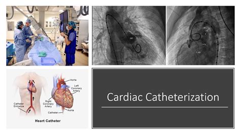 Cardiac Catheterization