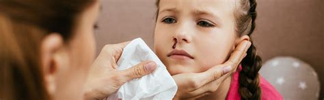 Nose Cauterisation - Treatment for Nosebleeds | ENT Specialists Group