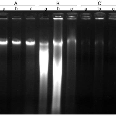 Three methods, including A) modified protocol, B) DNAse I treatment and ...