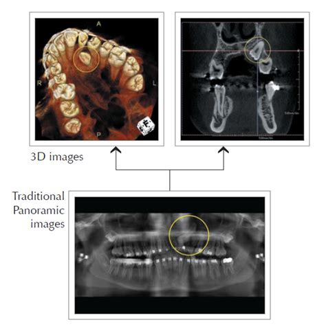 3D Dental Imaging in Greensburg, PA | Willowbrook Dental Associates