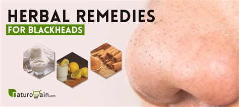 9 Simple and Best Home Remedies for Blackheads