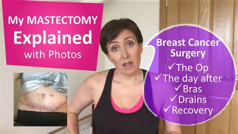 My breast cancer lumpectomy, mastectomy and reconstruction - YouTube