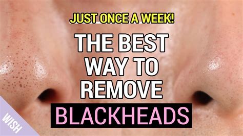 Ultimate Blackhead Removal & Preventing Tips | How to Remove Blackheads ...