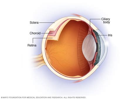 Iritis - Symptoms and causes - Mayo Clinic