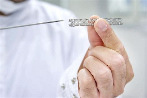 What is a stent? Uses, risks, and recovery