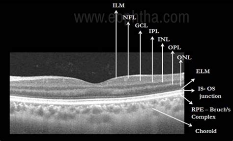 Retinal Layers Oct