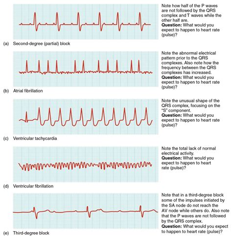 Cardiac Muscle and Electrical Activity | Anatomy and Physiology II